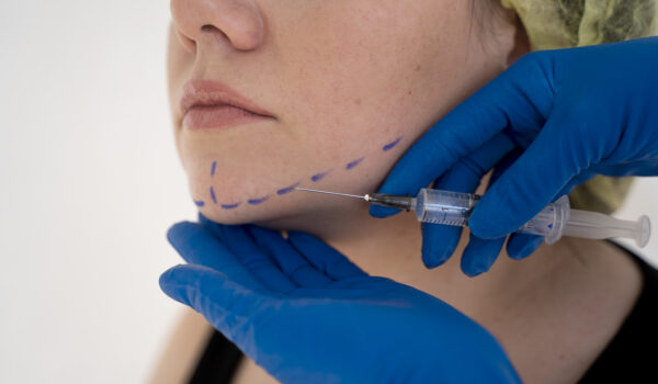 Dermal Fillers vs PDO Threads